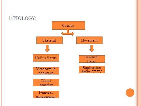 Intoeing causes